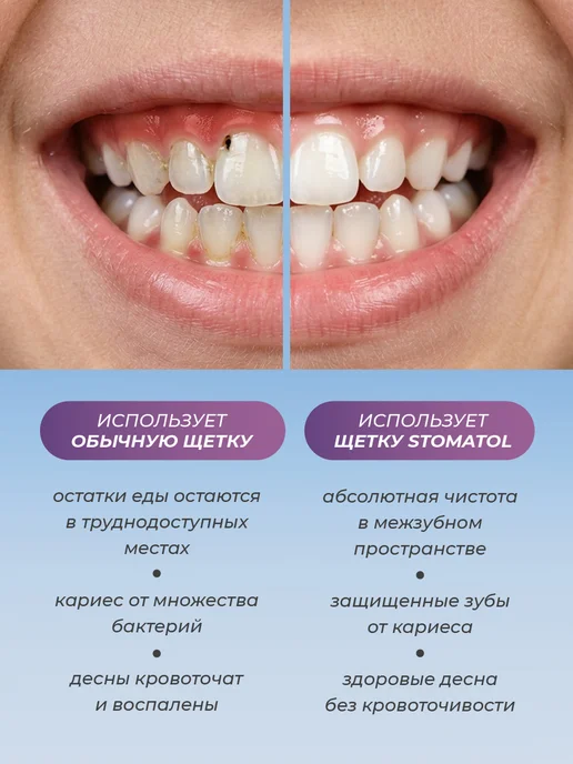 Stomatol Зубная щётка средней жесткости medium 1шт фиолетовая, 1 шт, фото 6