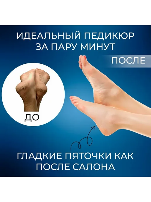 Пемза для ног Терка для пяток с нано зубцами сер, вариант, фото 6