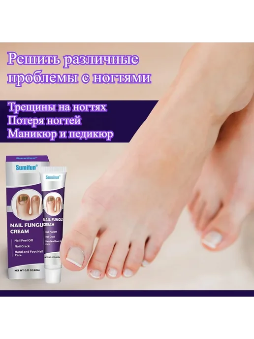 Крем для лечения онихомикоза, 20 г, питает ногти 20 г, 20 г, 20 г, фото 2