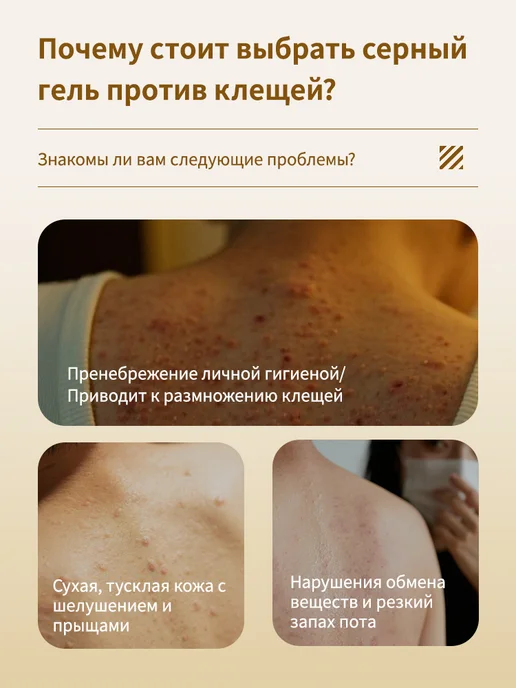 LYDIMOON Гель для душа от прыщей, сера против клещей и зуда, 500 мл, фото 2