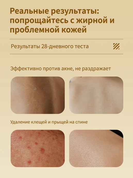 LYDIMOON Гель для душа от прыщей, сера против клещей и зуда, 500 мл, фото 4