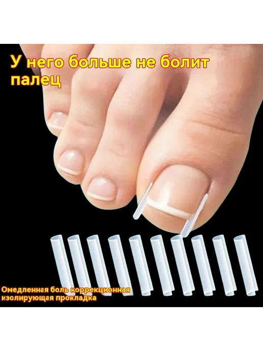Корректор вросшего ногтя 20 шт, 20 шт, фото 3