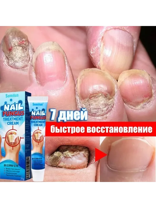 Средство для ногтей и кутикулы 20 мл, 20 мл