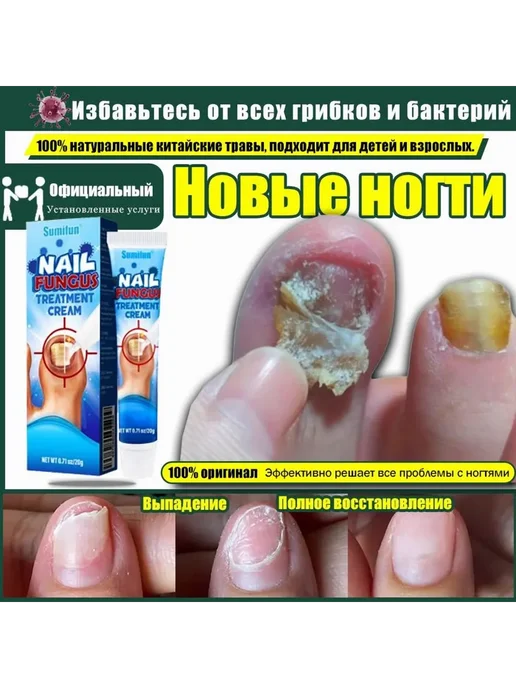 Средство для ногтей и кутикулы 20 мл, 20 мл, фото 2