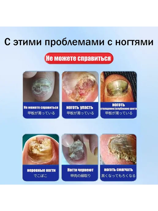 Средство для ногтей и кутикулы 20 мл, 20 мл, фото 3