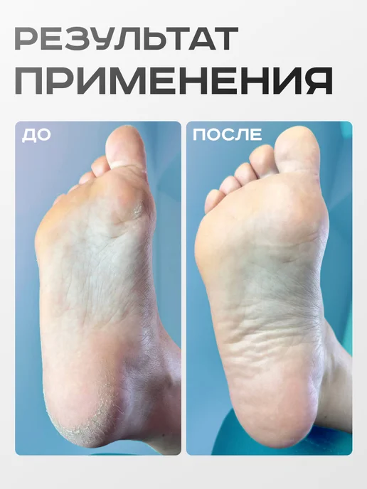 ELNAIL PRO Сменные файлы для педикюра SOFT M 100 грит Push Up, 50 шт, фото 5
