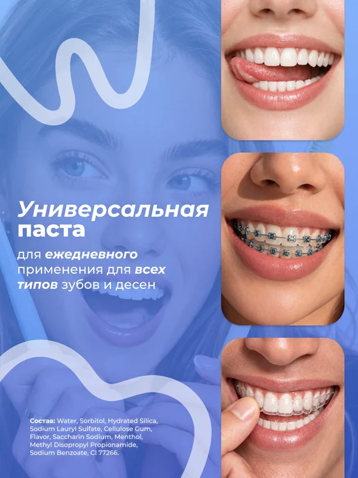 Weprove Зубная паста отбеливающая гелевая от кариеса и желтизны, желтый, фото 4
