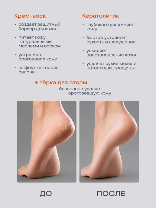 FOXY EXPERT Педикюрный набор кератолитик, крем воск и терка для стопы, вариант, фото 3