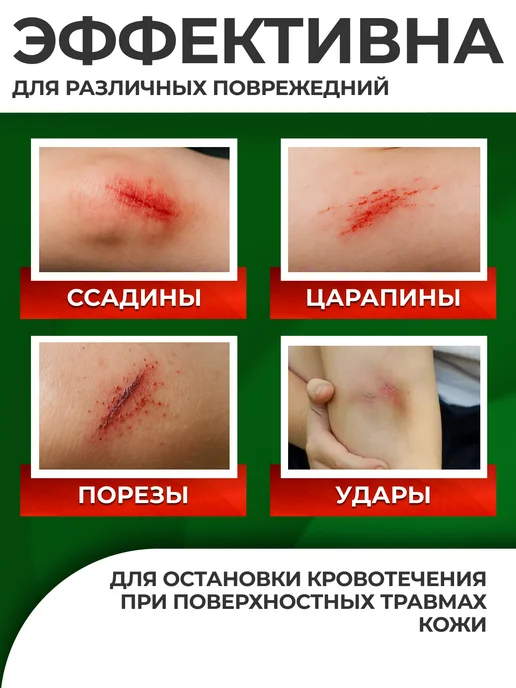 Апполо Повязка гемостатическая кровоостанавливающая 6х10 см, 6x10 см, фото 3