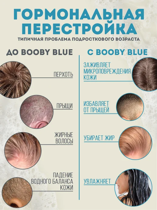 Booby Blue Набор очищающих шампуней для подростков 2x300 мл, 2x300, 300 мл, фото 2