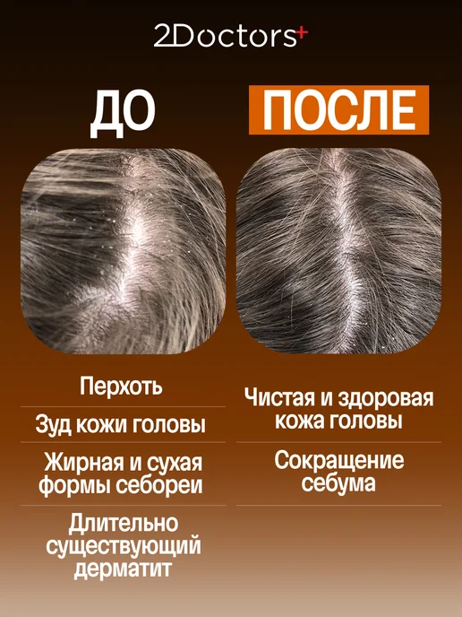 2Doctors Шампунь от перхоти, 250 мл, фото 3