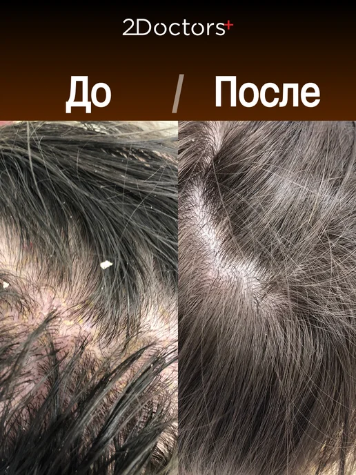 2Doctors Шампунь от перхоти, 250 мл, фото 4